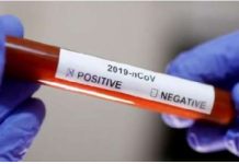 COVID-19: 58.0% male infected, 42.0% are female – Ghana Health Service