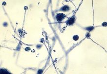 Meningitis deaths rise to 37 in Upper West