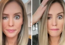 Blogger left deformed as botox treatment goes wrong
