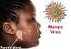 Mumps outbreak hits Keta in the Volta Region causes concern among residents